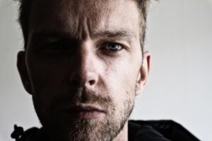 目元のたるみを消す方法はこれだ！あなたに合った解決策は？